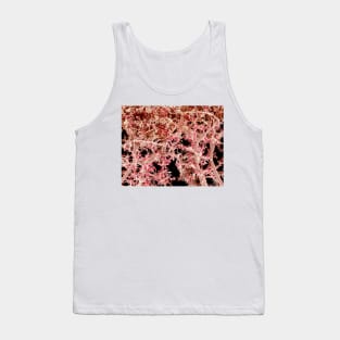 Kidney blood vessels, SEM (C022/7915) Tank Top